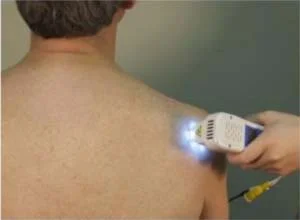 Chiropractic Leesburg VA Laser Therapy Chiropractic Leesburg VA Laser Therapy
